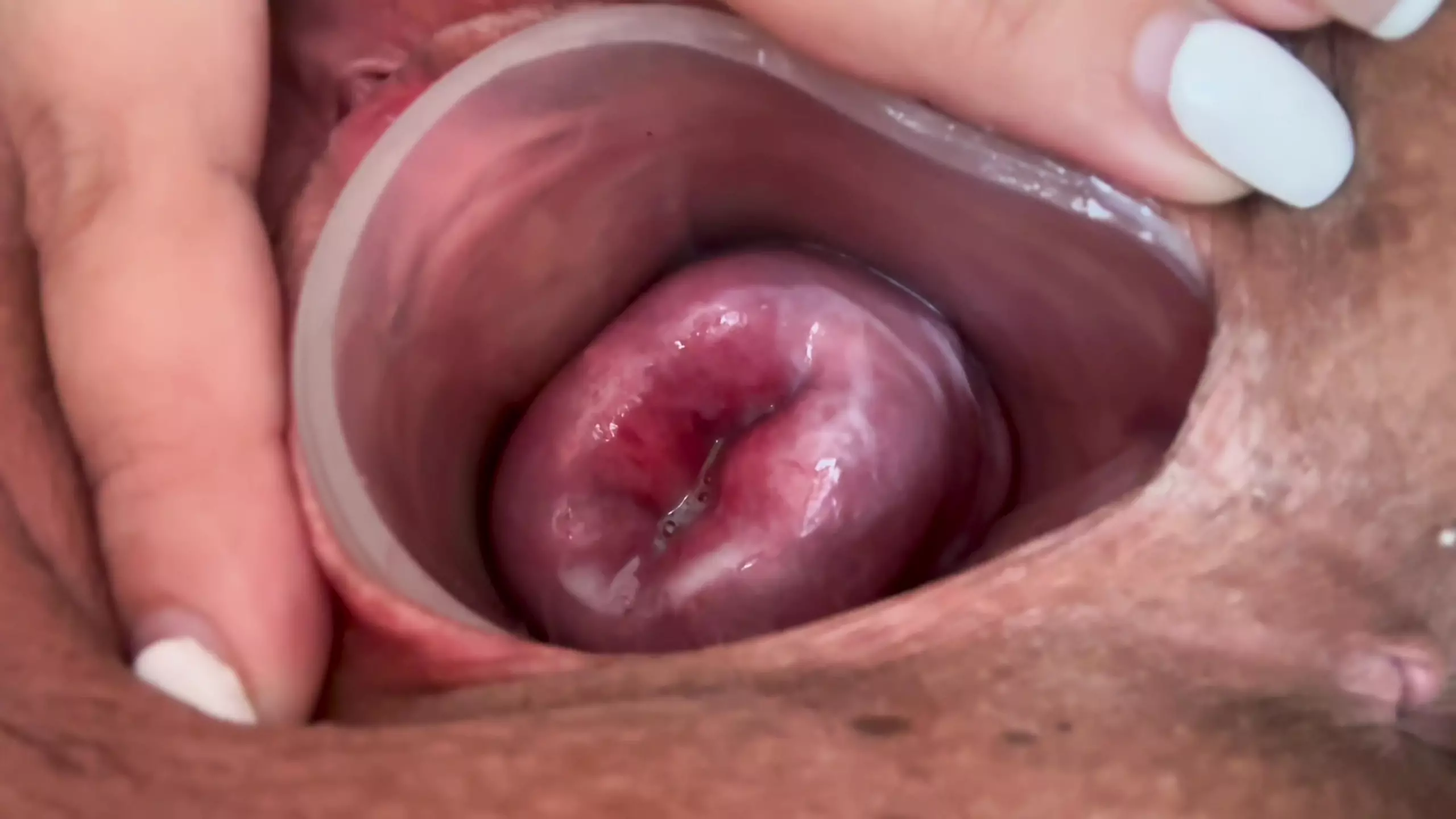 Small Cervix Without Dilating, Free New Small HD Porn 0c