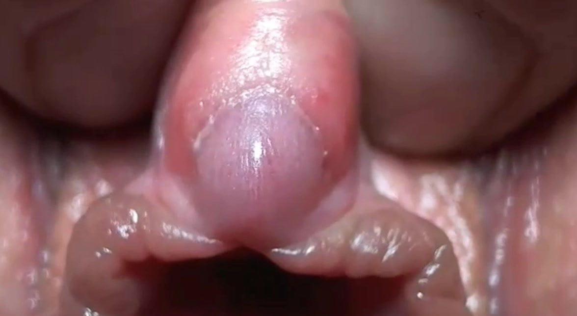 Close Up Clit Milky Squirt Free Xshare Mobile Porn Video B3