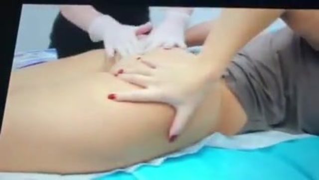 Porn anal bleaching Anal Bleaching,