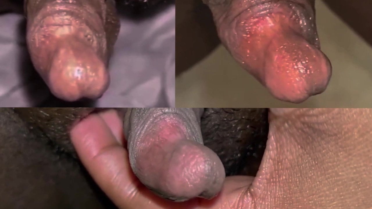 Klitoris Porn Pictures