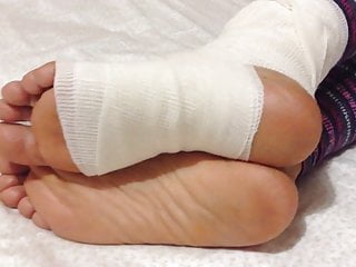 Bandaged sexy woman - Bandage feet of my wife