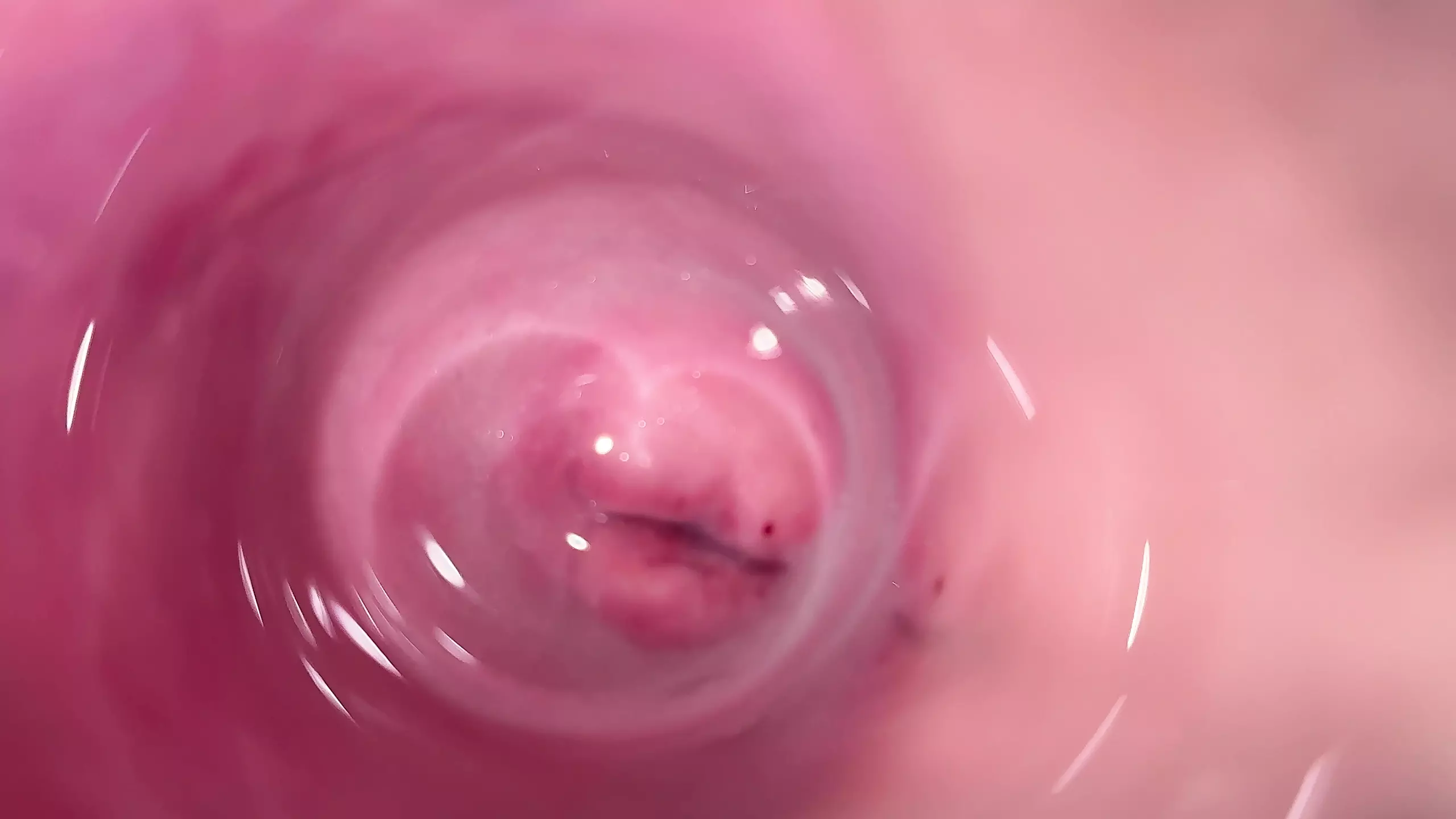 Camera Deep Inside Mias Creamy Pussy, Teen Cervix Close-Up photo