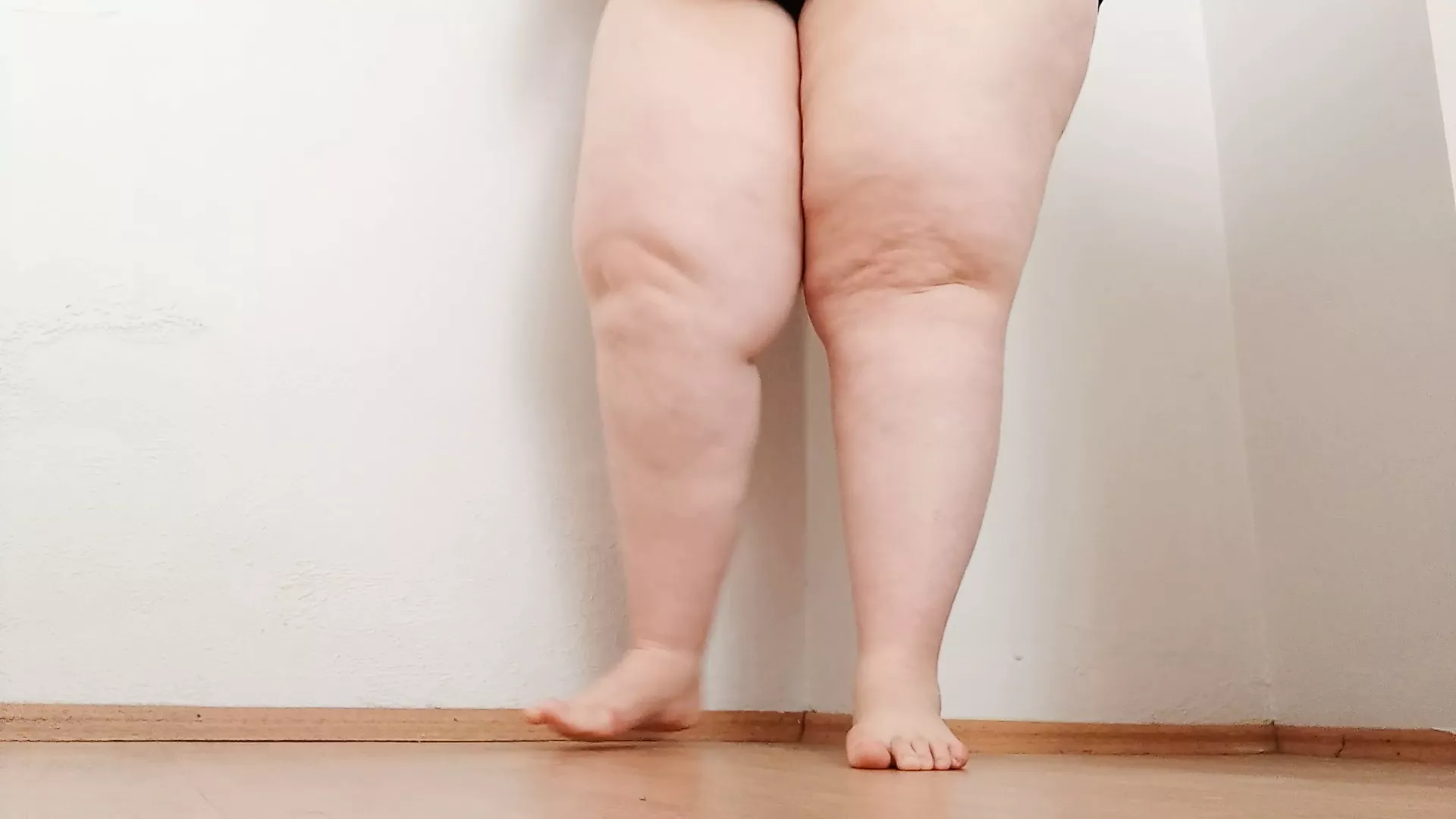 Ssbbw Thick Fat And Cellulite Legs Xhamster