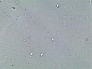 Sperm with antibodies swim up - Swimming sperm