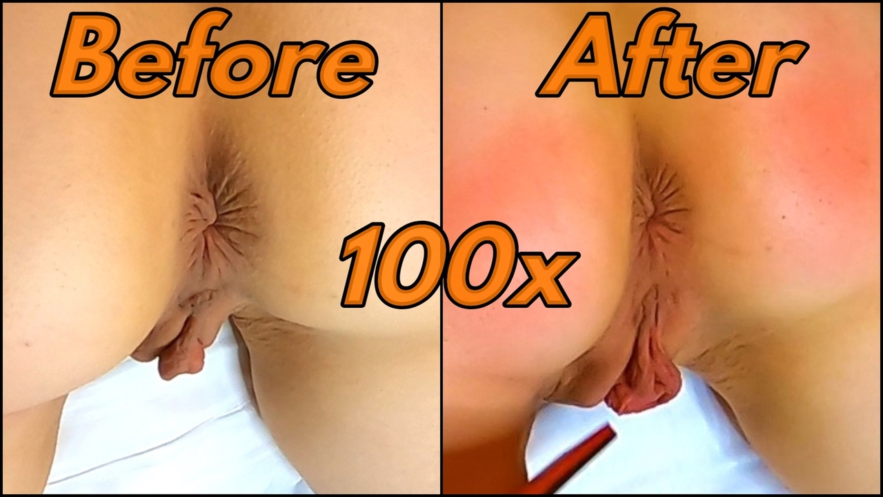 1280px x 720px - Enormous Pussy Swelling During Long Spanking Session 100 Hits on Perfect  Ass | xHamster
